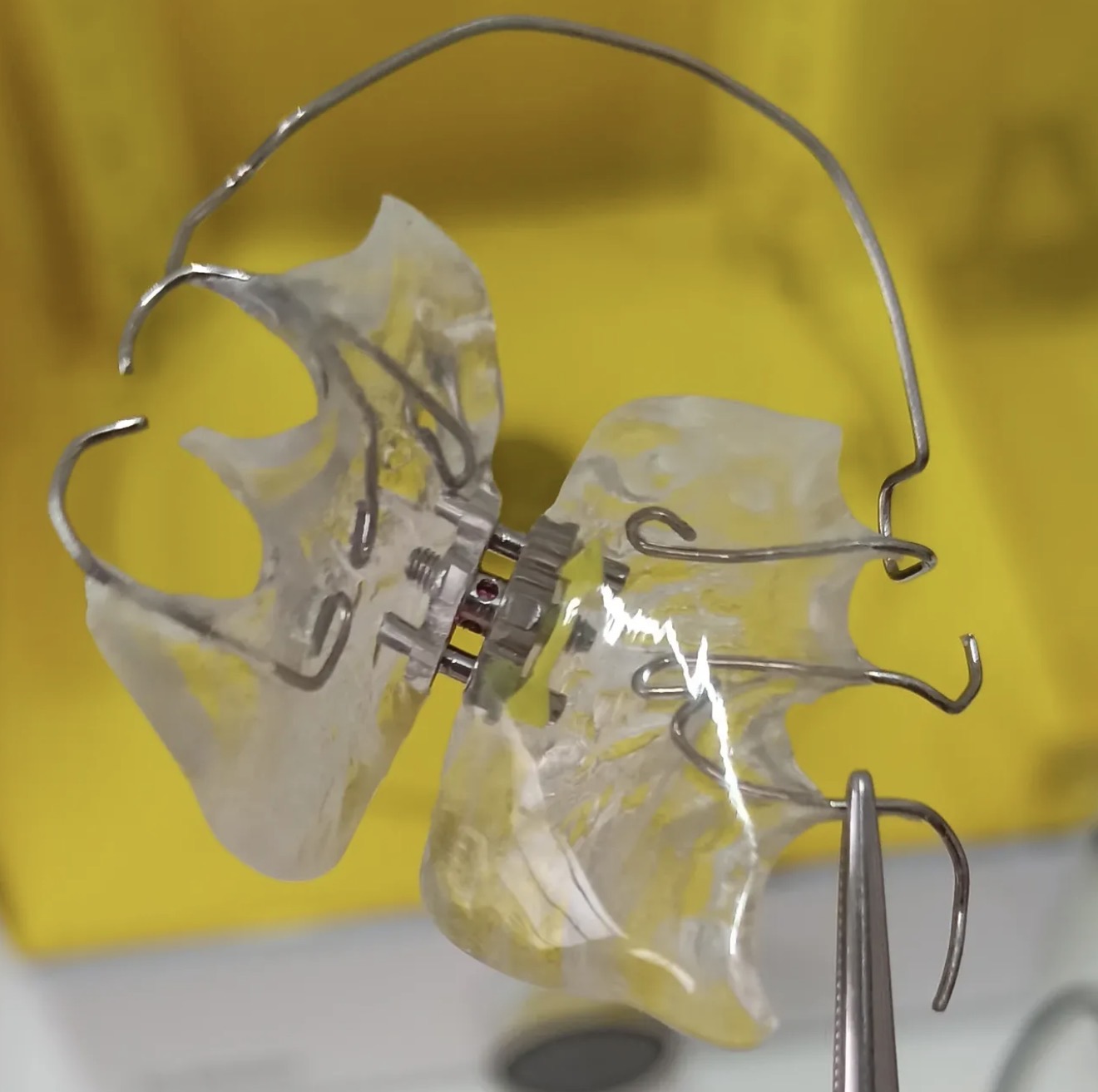 Armature avec attache implantaire de précision et arc métallique