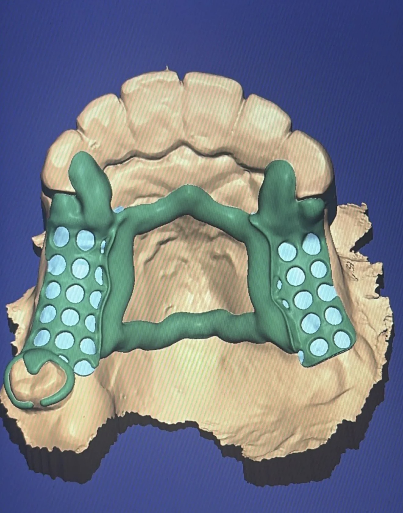Conception CAD/CAM d'un châssis métallique sur modèle numérique